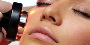 radiofrecuencia facial